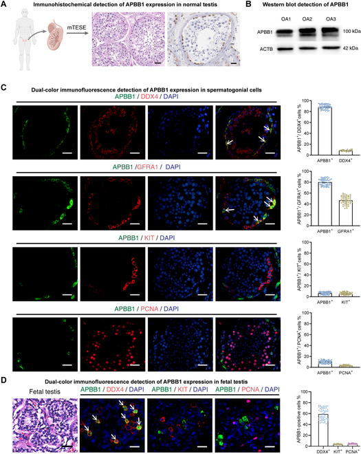Essential Regulation Of Spermatogonial Stem Cell Fate Decisions And Male Fertility By Apbb1 Via Interaction With Kat5 And Gdf15 In Humans And Mice Research