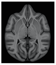 The Brain Of The Chimpanzee Chapter 19 Chimpanzee
