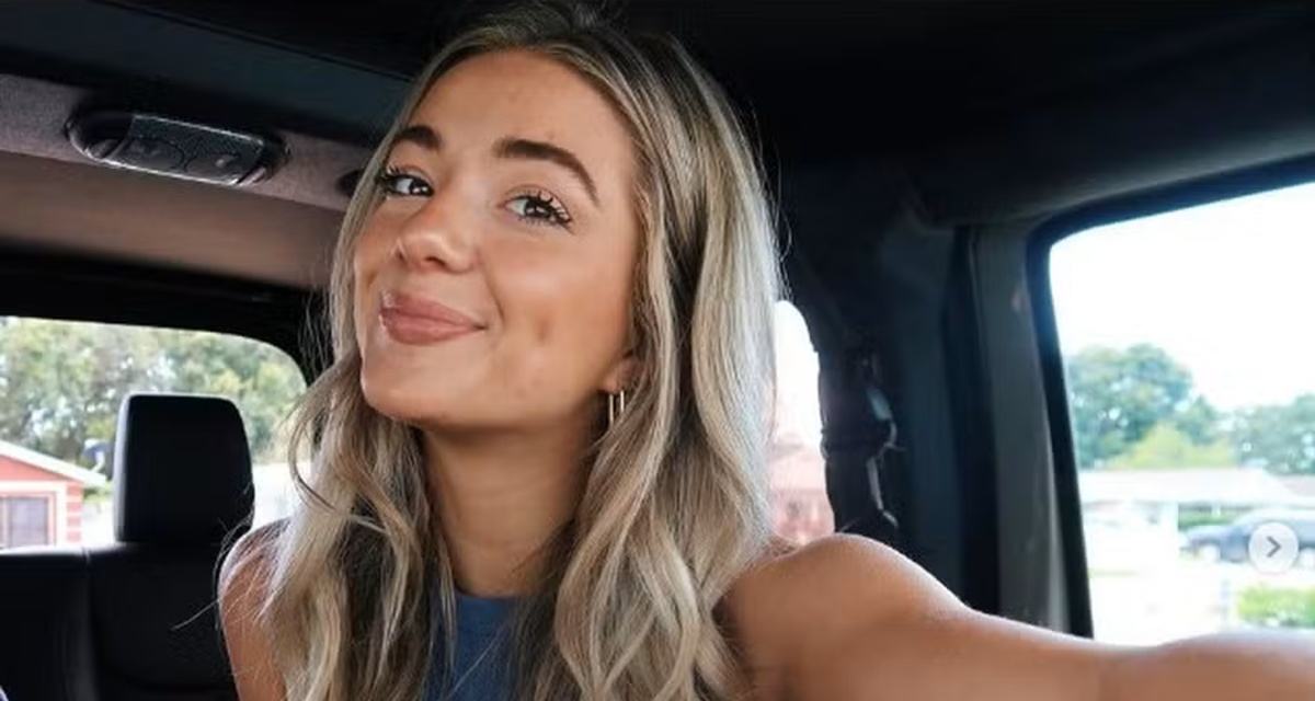 V Tima De Ataque De Tubar O Faz Sucesso Como Modelo Cicatriz Fascina V Tima De Ataque De Tubar O Faz Sucesso Como Modelo Cicatriz Fascina